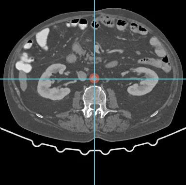 Axial CT slice