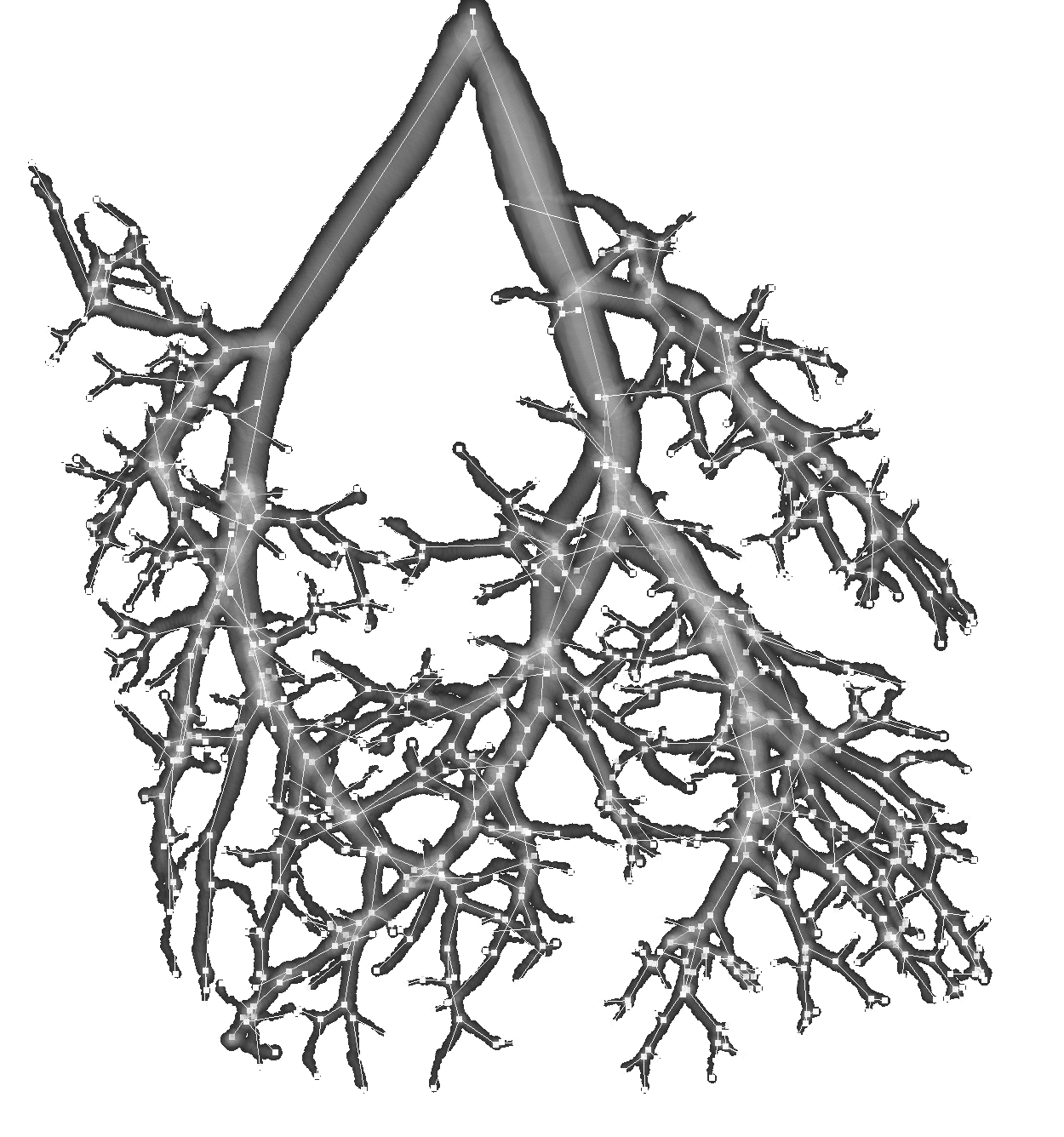 Pulmonary vascular tree with detected anomalies marked